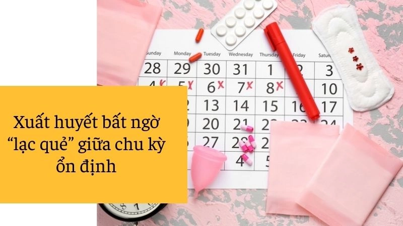 Xuất huyết bất ngờ “lạc quẻ” giữa chu kỳ ổn định