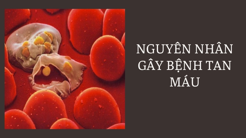 Nguyên nhân gây bệnh tan máu bẩm sinh phổ biến