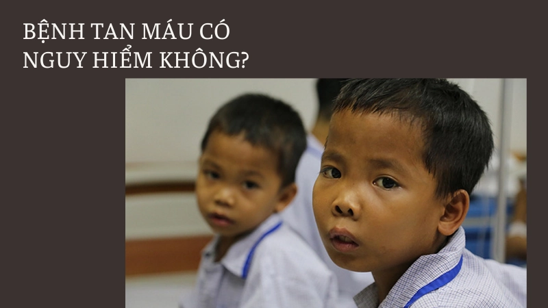 Bệnh tan máu bẩm sinh có nguy hiểm không?