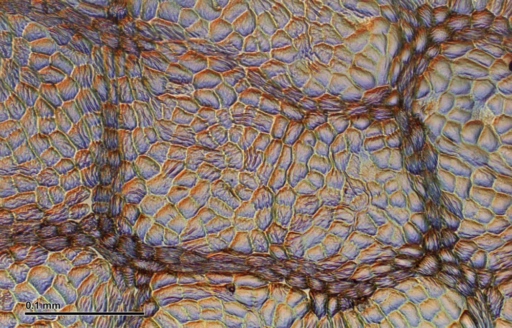 Lớp cutin trên biểu bì giúp ngăn chặn sự thoát hơi nước quá mức, đặc biệt quan trọng ở cây chịu hạn.