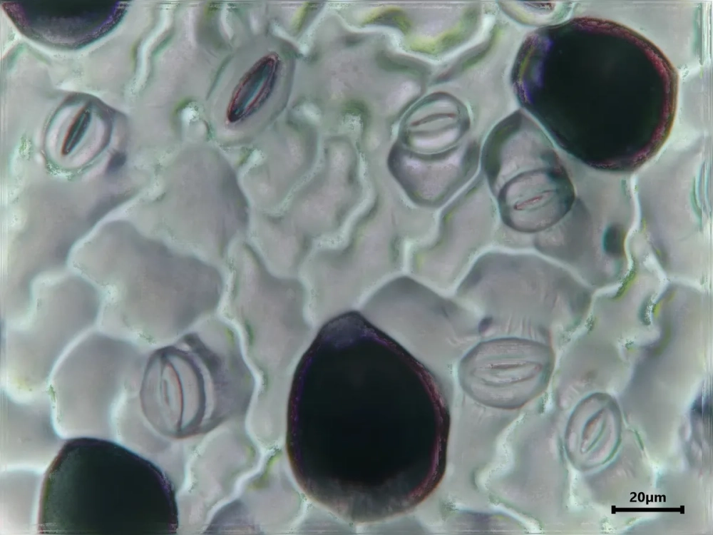 Khác với thực vật, Cấu tạo lớp biểu bì da người gồm nhiều lớp tế bào phức tạp hơn như lớp hạt, lớp gai.