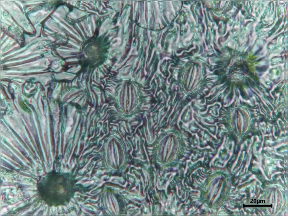 Hình ảnh minh họa Đặc điểm cấu tạo biểu bì với các tế bào xếp khít nhau, không để lại khoảng trống gian bào.