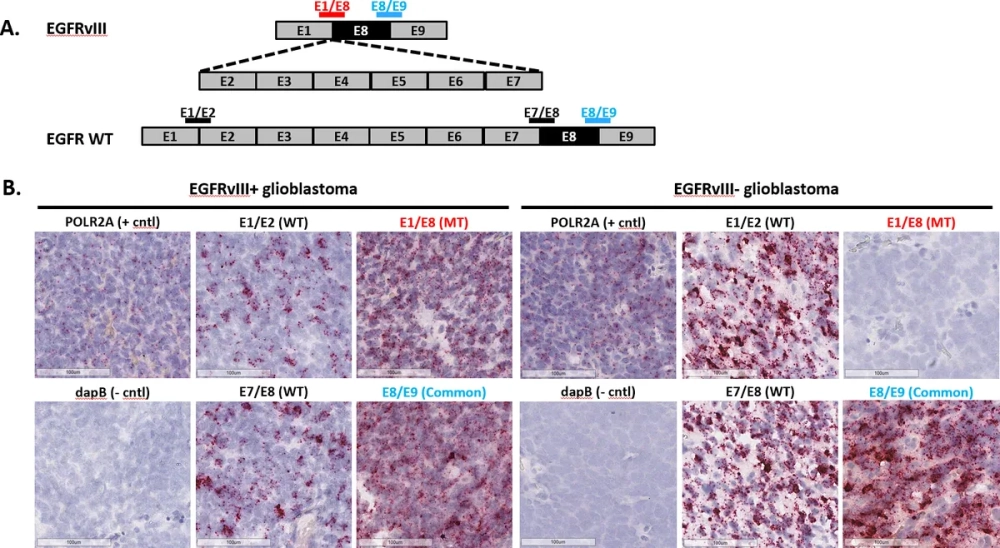Sự xuất hiện của đột biến gen lặn qua các thế hệ