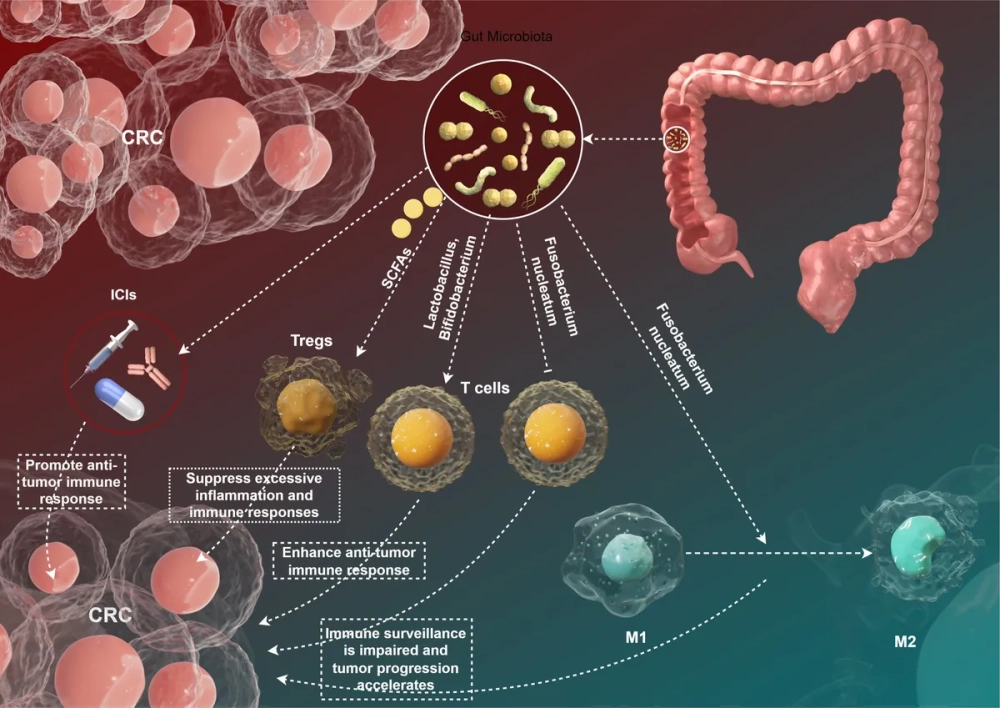 Thực phẩm lên men tự nhiên chứa nhiều vi khuẩn có lợi cho đường ruột