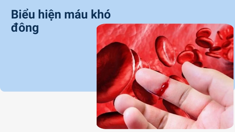 Dấu hiệu máu khó đông dễ bỏ qua