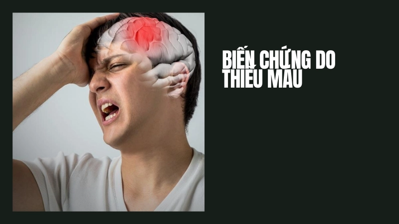Biến chứng chết người do phát hiện thiếu máu muộn
