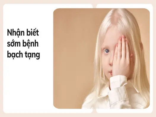 Cách nhận biết bệnh bạch tạng và phương pháp chăm sóc hiệu quả