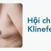 Hội chứng Klinefelter khiến nhiều người chủ quan bỏ qua