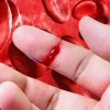 Bệnh Mù Màu và Máu Khó Đông: Hiểu Rõ Cơ Chế Di Truyền
