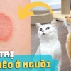 Bị nấm mèo ở người bao lâu thì khỏi và cách điều trị hiệu quả