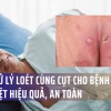 Các loại thuốc trị lở loét cho người già hiệu quả và cách sử dụng