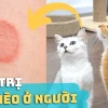 Cách chữa nấm mèo ở người an toàn và hiệu quả