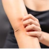 Ghẻ chó có lây sang người không và cách phòng tránh hiệu quả