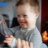 Hội chứng Down ở người: Dạng đột biến nhiễm sắc thể cần hiểu rõ
