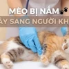 Hướng dẫn chi tiết cách trị nấm mèo ở người an toàn và hiệu quả