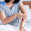 Ký sinh trùng trên da người những điều cần biết và cách xử lý