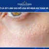 Mụn Hạt Kê Ở Người Lớn: Nguyên Nhân, Nhận Biết và Cách Xử Lý Hiệu Quả