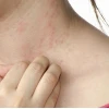 Ngứa khắp người không rõ nguyên nhân: Nguyên nhân và cách khắc phục hiệu quả