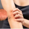 Ngứa Râm Ran Khắp Người Vào Ban Đêm: Nguyên Nhân và Cách Xử Lý Hiệu Quả