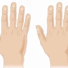 Người có 6 ngón tay: Giải mã ý nghĩa và quan niệm trong nhân tướng học