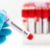 Người lành mang gen Thalassemia cần lưu ý gì?