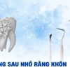 Nhổ răng khôn chết người: Nguy cơ tiềm ẩn và cách phòng tránh