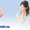 Nổi chấm đỏ trên da: Nguyên nhân, dấu hiệu và cách điều trị hiệu quả 2026
