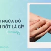 Nổi mẩn đỏ ngứa như muỗi đốt: Nguyên nhân, triệu chứng và cách xử lý hiệu quả