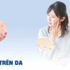 Nổi nhiều nốt đỏ trên người: Nguyên nhân và cách xử lý hiệu quả