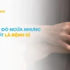 Nóng phát ban ở người lớn: Nguyên nhân, triệu chứng và cách xử lý hiệu quả