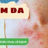 Thuốc trị hăm nách người lớn: Nguyên nhân, cách điều trị và phòng ngừa hiệu quả