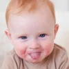 Trẻ bị nổi mẩn đỏ khắp người không sốt: Nguyên nhân và cách xử lý hiệu quả