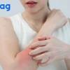 Tự dưng bị ngứa khắp người: Nguyên nhân và cách xử lý hiệu quả 2026
