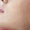 Vì sao bị ngứa khắp người và cách khắc phục hiệu quả