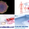 Công Nghệ Tế Bào Gốc Cảm Ứng IPSC Khám Phá Tiềm Năng