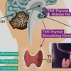 Tuyến Giáp và Hormone Thyroxine Điều Hòa Chuyển Hóa Cơ Thể