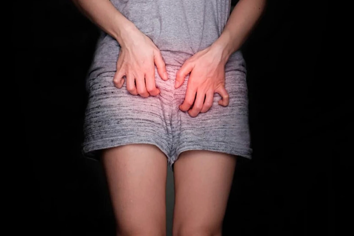 Cách trị hăm da ở người lớn hiệu quả và phòng ngừa tái phát