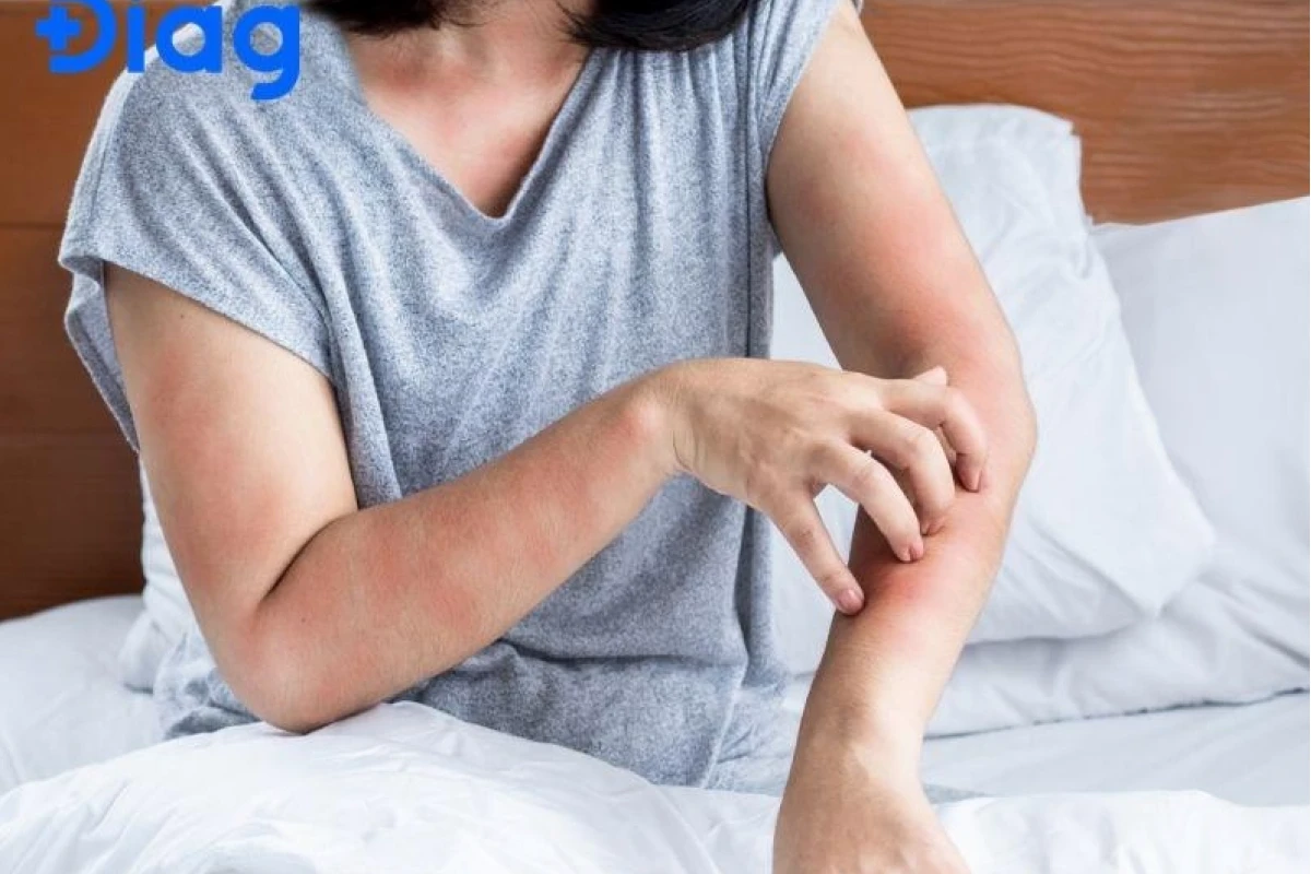 Ký sinh trùng trên da người những điều cần biết và cách xử lý