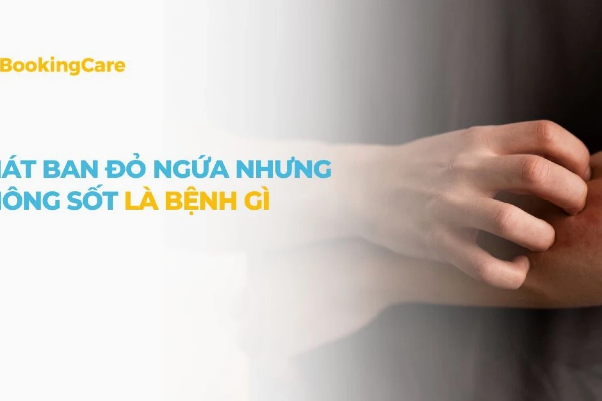 Nóng phát ban ở người lớn: Nguyên nhân, triệu chứng và cách xử lý hiệu quả