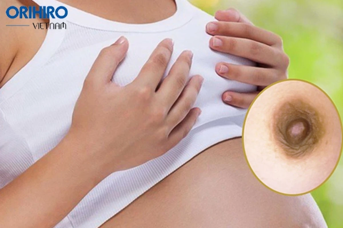 Núm vú đen: Nguyên nhân, dấu hiệu và cách khắc phục hiệu quả