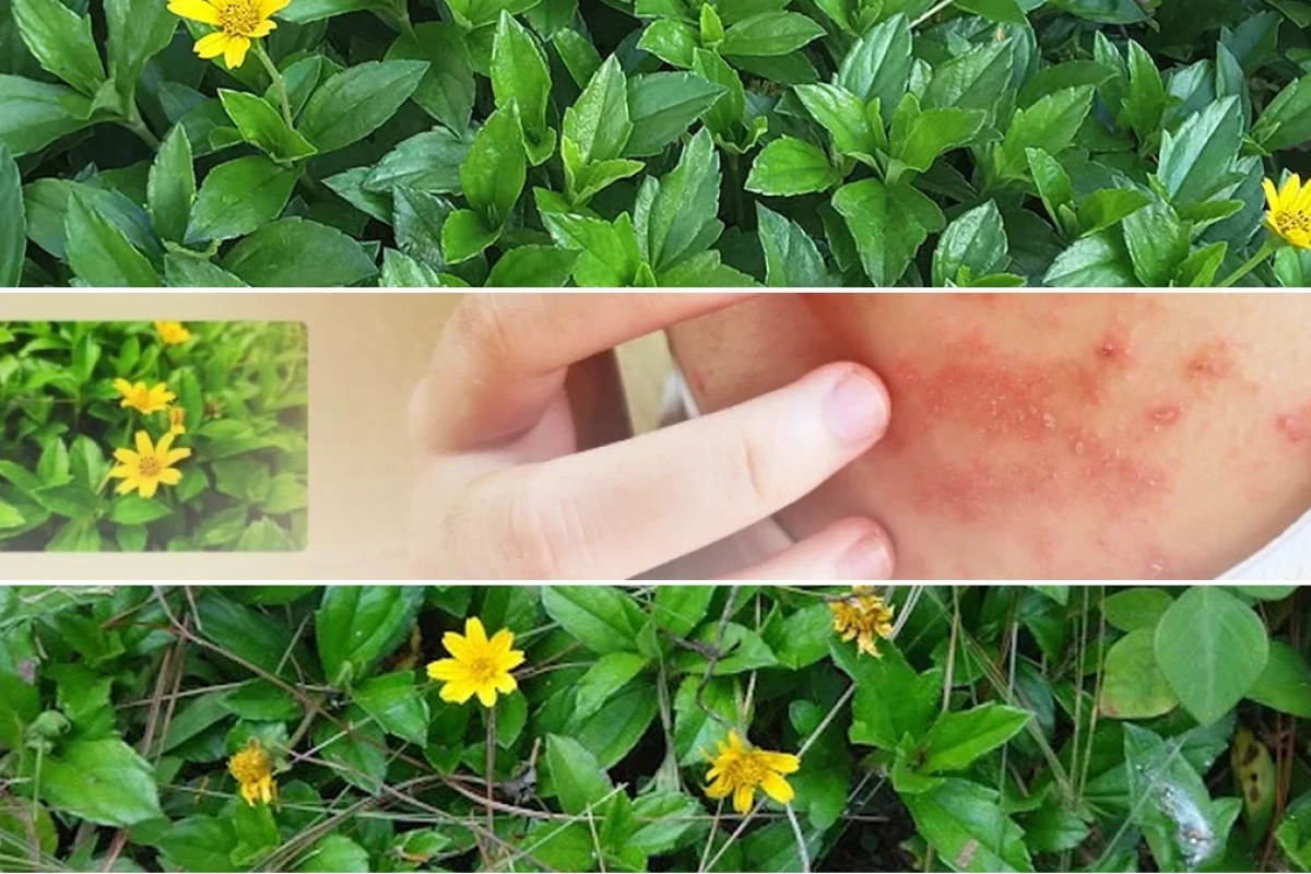 Sài Đất Công Dụng Kháng Viêm Dân Gian