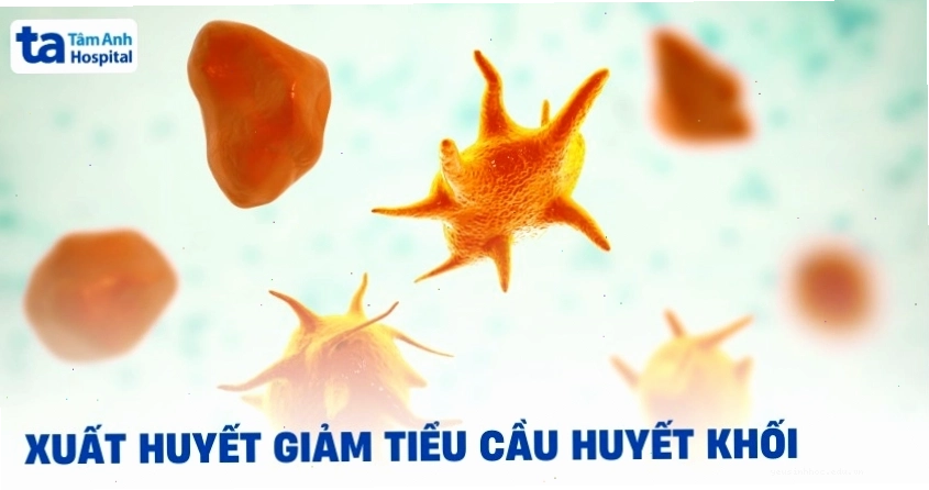 Ban xuất huyết giảm tiểu cầu huyết khối (TTP) là một dạng rối loạn huyết khối nghiêm trọng