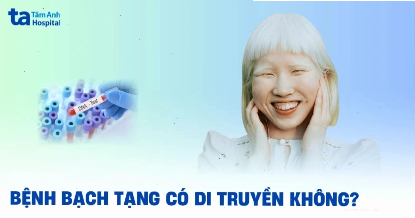 Bệnh bạch tạng có di truyền không và dựa trên đặc điểm nào