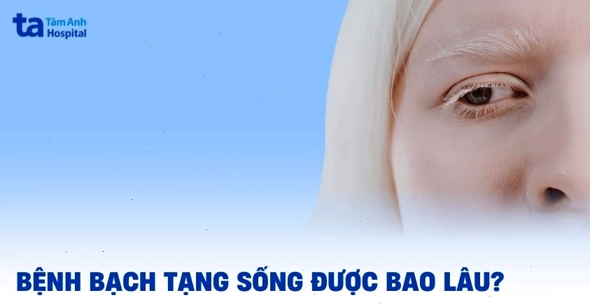 Bệnh bạch tạng sống được bao lâu