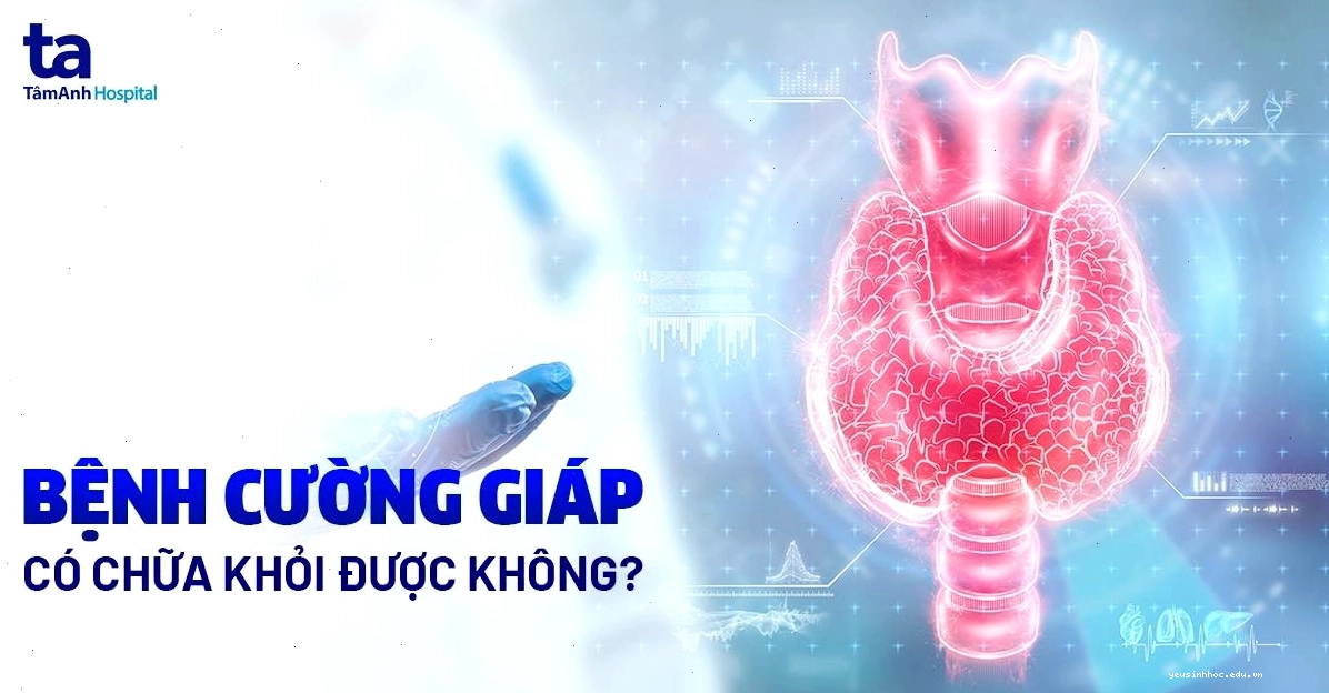 Bệnh cường giáp có thể chữa khỏi và cần theo dõi định kỳ