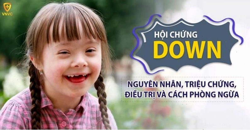 Bệnh Down ở trẻ em