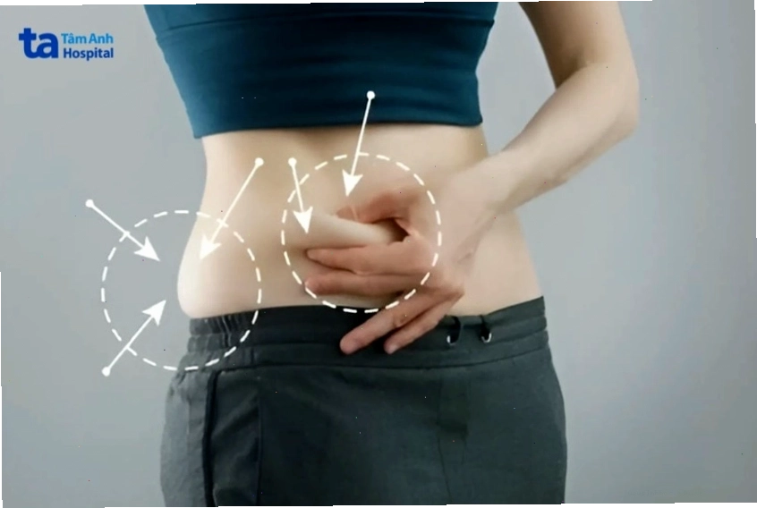 Béo bụng dưới có thể do yếu tố di truyền ở một số người