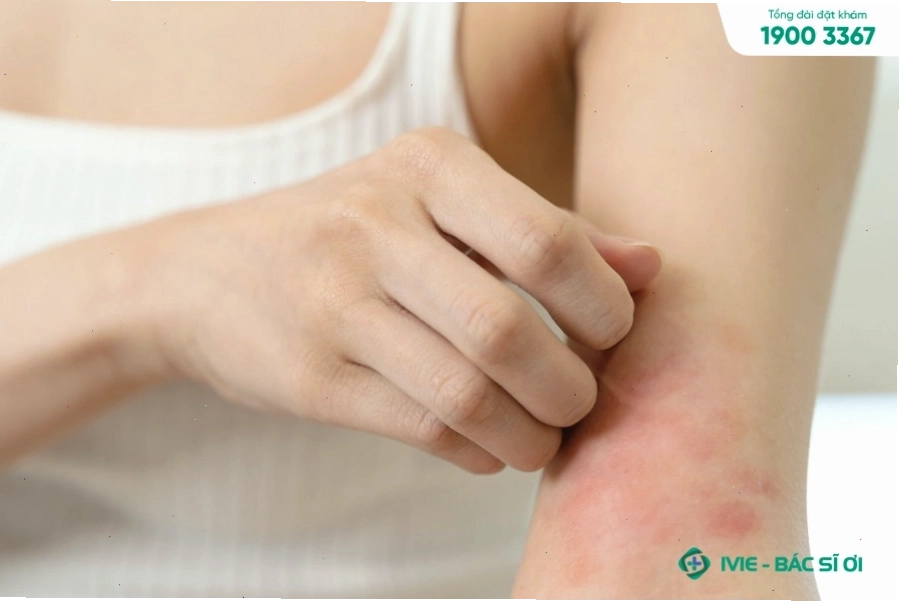 Bị ngứa sau khi quan hệ ở nam giới, nữ giới