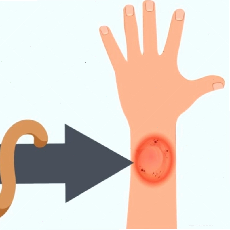 Biện pháp vệ sinh và chăm sóc tại nhà giúp hỗ trợ điều trị nấm mèo ở người
