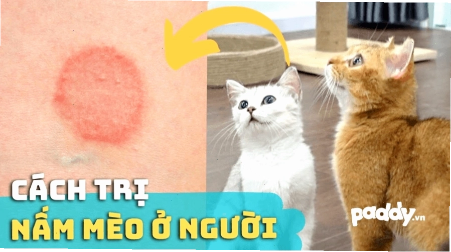 Biểu hiện của bệnh nấm mèo ở người gây ngứa rát da